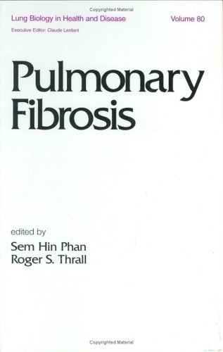 Pulmonary-Fibrosis