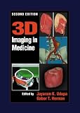 3D Imaging in Medicine, Second Edition