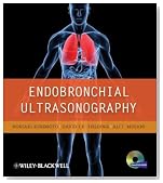 Endobronchial Ultrasonography