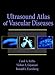 Book Ultrasound Atlas of Vascular Diseases