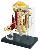 Cervical Spine Model with Muscles and Nerves Including Brachial Plexus
