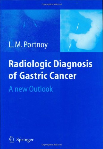 Gastric-Cancer