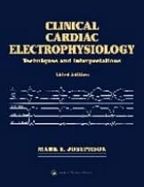 Clinical Cardiac Electrophysiology: Techniques and Interpretations
