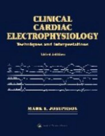 Clinical Cardiac Electrophysiology: Techniques and Interpretations