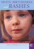 Spots and rashes