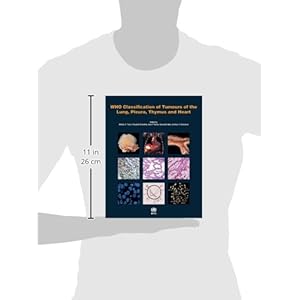 WHO Classification of Tumours of the Lung, Pleura, Thymus and Heart (IARC WHO Classification of Tumours)