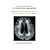 Correction-Treatment of The Platelet Hyper-aggregability: Can Prevent Dementia, Even Cure Migraine, Vertigo, Dizziness, Syncope and Others