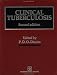 Clinical Tuberculosis