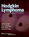 Hodgkin Lymphoma