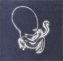 &Aacute;g&aelig;tis Byrjun