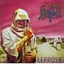 Leprosy