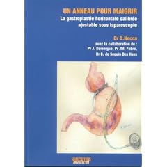 Un anneau pour maigrir. La gastroplastie horizontale calibr�e ajustable sous laparoscopie
