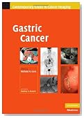 Gastric Cancer (Contemporary Issues in Cancer Imaging)