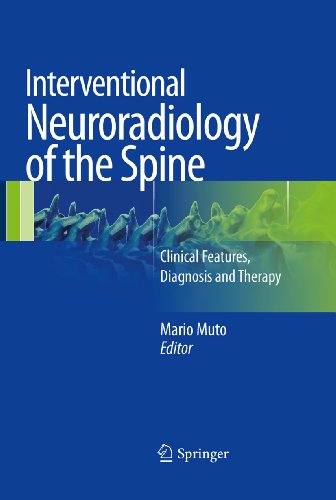 Interventional Neuroradiology of the Spine: Clinical Features, Diagnosis and Therapy