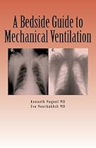 A Bedside Guide to Mechanical Ventilation