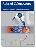 Atlas of Colonoscopy: Examination Techniques and Diagnosis