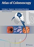 Atlas of Colonoscopy: Examination Techniques and Diagnosis