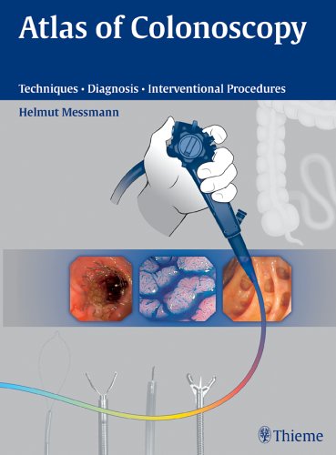 Critical-Care
