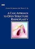 4175YVZWKXL. SL160  A Case Approach to Open Structure Rhinoplasty