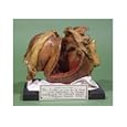 Model of a Tumour of the Left Ventricle, 1799 Art Giclee Poster Print by French School, 24x18