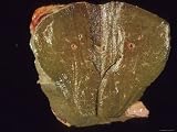 Cirrhosis Liver Specimen Photographic Poster Print, 16x12