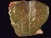 Cirrhosis Liver Specimen Photographic Poster Print, 16x12