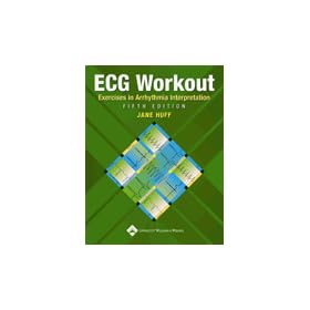 Click here to buy ECG Workout Exercises in Arrhythmia Interpretation Softbound.