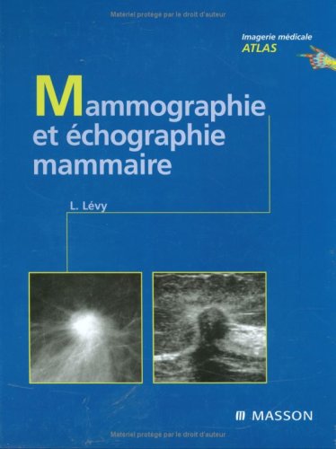 echographie des seins