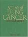 Atlas of Lung Cancer