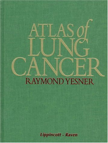 Atlas of Lung Cancer