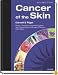 Cancer of the Skin: Text with CD-ROM