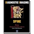 Diagnostic Imaging: Spine by  Jeff Ross, Michael Brant-Zawadzki, Mark Chen, and Kevin Moore