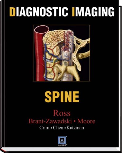 Diagnostic Imaging: Spine
