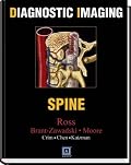 Diagnostic Imaging: Spine