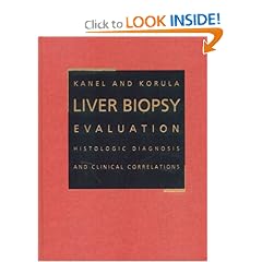 Liver Biopsy Evaluation:  Histologic Diagnoses with Clinical