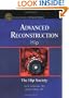 Advanced Reconstruction Hip (Advanced Reconstruction)