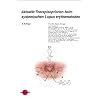 Aktuelle Therapieoptionen beim systemischen Lupus erythematodes