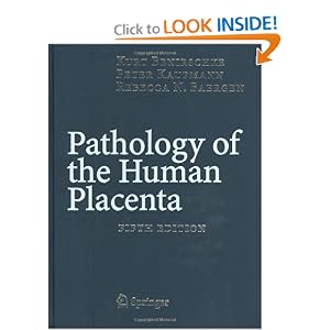 Click here to buy Pathology of the Human Placenta, Fifth Edition by Kurt Benirschke, Peter Kaufmann, and Rebecca N. Baergen.