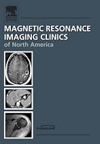 Cartilage, An Issue of Magnetic Resonance Imaging Clinics: 14-3 (The Clinics: Radiology)
