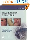 Cutaneous Manifestations of Rheumatic Diseases