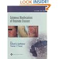 Cutaneous Manifestations of Rheumatic Diseases by Richard D. Sontheimer and Thomas T. Provost