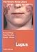 Book Everything You Need to Know About Lupus (Need to Know Library)