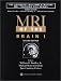Books : MRI of the Brain I