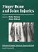 Finger Bone and Joint Injuries