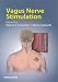 Book Vagus Nerve Stimulation