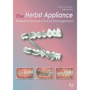 Click here to buy The Herbst Appliance: Research-based Clinical Management by Hans Pancherz and Sabine Ruf.
