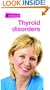 Thyroid Disorders (Simple Guides)