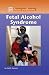 Books : Fetal Alcohol Syndrome (Diseases and Disorders)