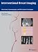 Interventional Breast Imaging: Ultrasound, Mammography, and MR Guidance Techniques Interventional Breast Imaging: Ultrasound, Mammography, and MR Guidance Techniques