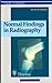 Normal Findings in Radiography